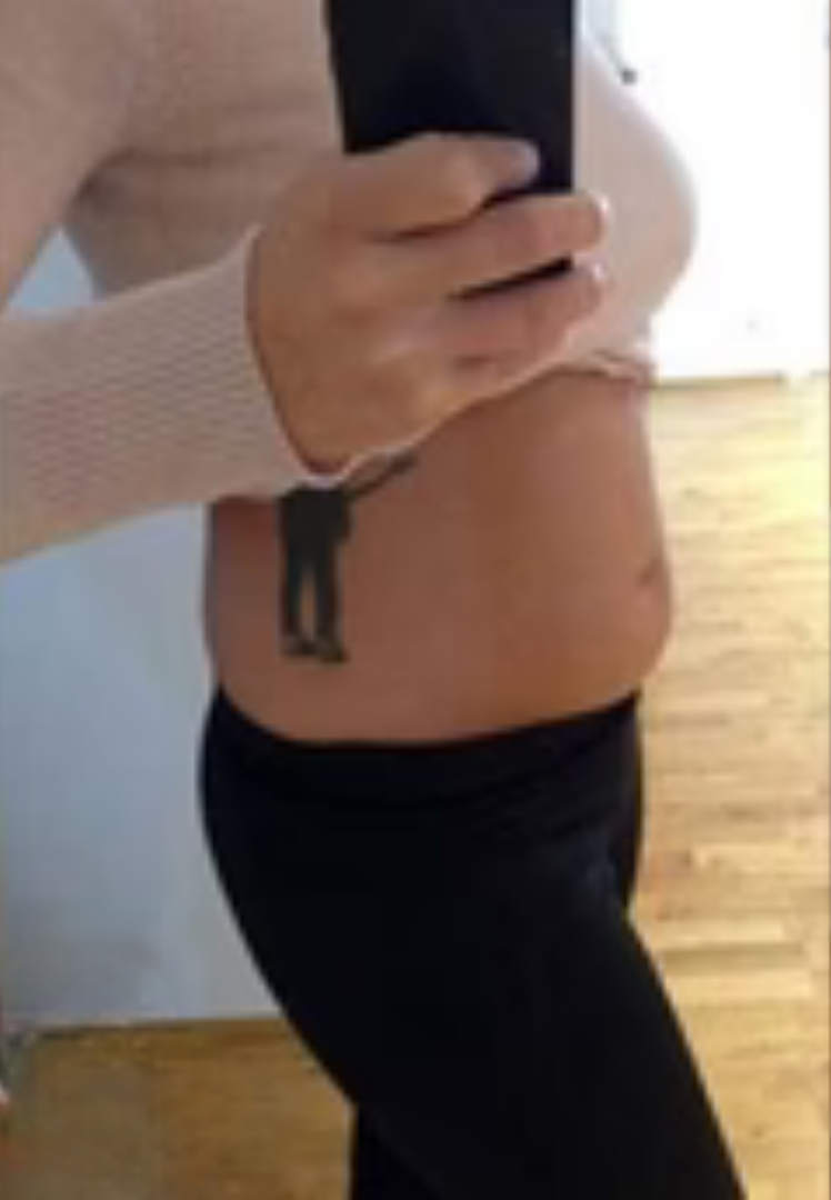 Before image