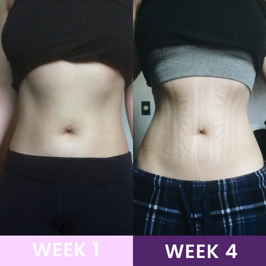 Waist Trainer | Lose Inches in Weeks Waivona